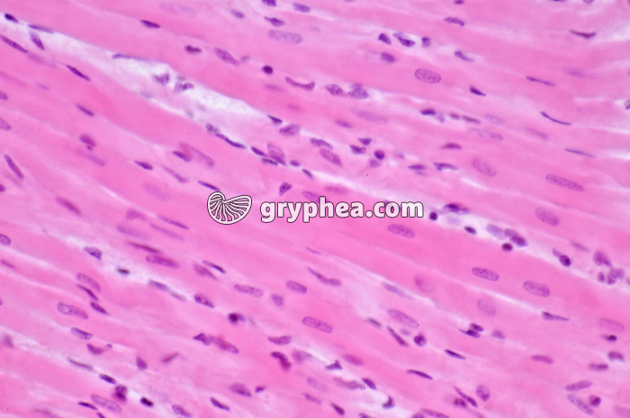 Mucle cardiaque CL x160 - gryphea.com